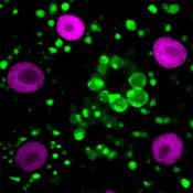 Two independent mechanisms are involved in tuberous sclerosis