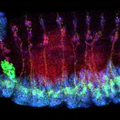 An international team discovers a novel Alzheimer’s disease risk gene among Icelanders