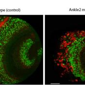 Study reveals how maternal Zika virus infection results in microcephaly among newborns