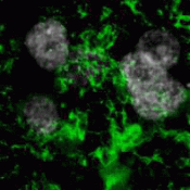 Fruit fly study identifies a new link to aortic aneurysms