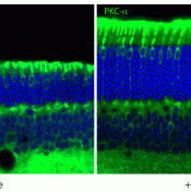 A simple sugar delays neurodegeneration in lysosomal storage disorders