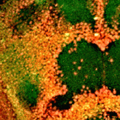 Fruit flies help uncover a role for IRF2BPL in a new rare neurological disorder