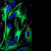 Breakdown of brain cells’ metabolic collaboration linked to Alzheimer’s disease