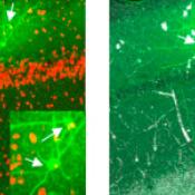 Deep brain stimulation can correct neural network malfunction in Rett syndrome mice 