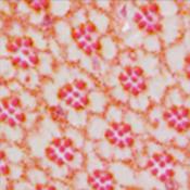Five new candidate genes for Parkinson’s disease identified