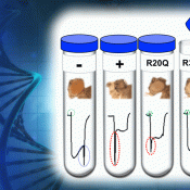Fruit fly study links TBX2 to a novel Mendelian disorder 