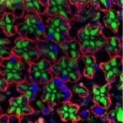 Loss of Frataxin causes neurodegeneration due to iron toxicity