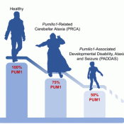 Changes in Pumilio1 levels linked to distinct neurological disorders