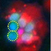 Insufficient energy production by mitochondria causes photoreceptor neurons to degenerate