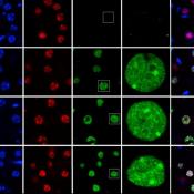 Mutation location is the key to prognosis
