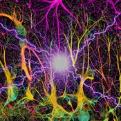 Neuronal hyperactivity accelerates the loss of neural stem cells