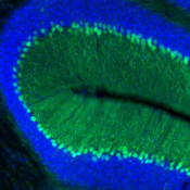 Regulating gene regulatory regions offers a novel mechanism to control ATXN1 levels
