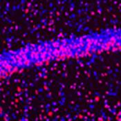 Deep brain stimulation can correct neural malfunction in Rett and MeCP2 duplication syndrome mice 