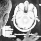 CURE Epilepsy’s Day of Science: March 30