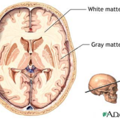 Inappropriate cellular response to stress linked to a new neurological disorder