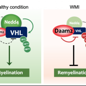 Novel regulators of myelin repair and regeneration discovered 
