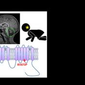 Studies on a young ataxia patient could guide treatment for a novel condition