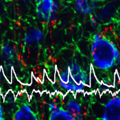 Xue lab develops a better optogenetic tool to study neuronal function