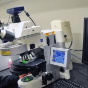 Discovery improves understanding of Lou Gehrig's disease
