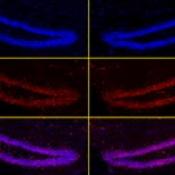 Deep brain stimulation restores learning and memory in Rett Syndrome mice