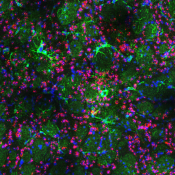 Downregulating glial genes involved in synapse function protects from Huntington's disease