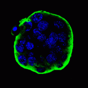 Mutations in an early embryonic development gene may cause female infertility