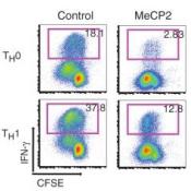 MECP2 duplication affects immune system as well as brain development