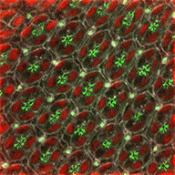 Research reveals a novel link between congenital cataracts and dynamin-binding protein  