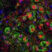 A possible new therapeutic target for Alzheimer’s and Parkinson’s diseases identified