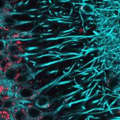 A potential therapeutic target for juvenile Batten disease