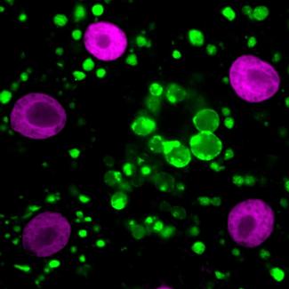 Two independent mechanisms are involved in tuberous sclerosis