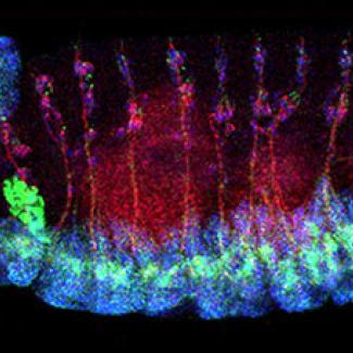 An international team discovers a novel Alzheimer’s disease risk gene among Icelanders