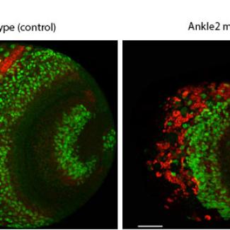 Study reveals how maternal Zika virus infection results in microcephaly among newborns