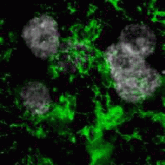 Fruit fly study identifies a new link to aortic aneurysms