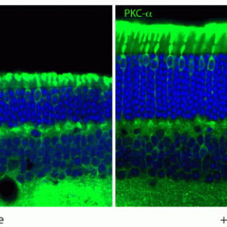 A simple sugar delays neurodegeneration in lysosomal storage disorders