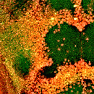 Fruit flies help uncover a role for IRF2BPL in a new rare neurological disorder