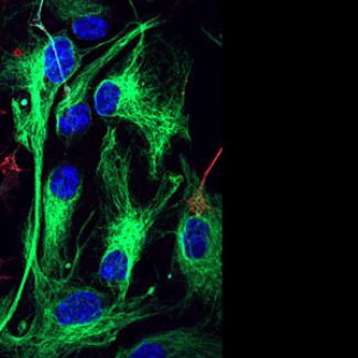 Breakdown of brain cells’ metabolic collaboration linked to Alzheimer’s disease