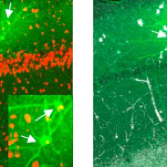 Deep brain stimulation can correct neural network malfunction in Rett syndrome mice