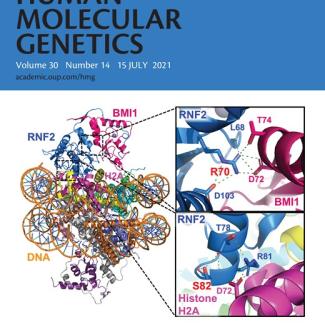 A novel neurological disorder associated with the Polycomb complex identified