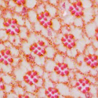 Five new candidate genes for Parkinson’s disease identified