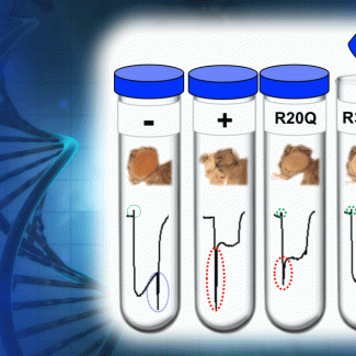 Fruit fly study links TBX2 to a novel Mendelian disorder