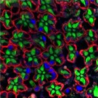 Loss of Frataxin causes neurodegeneration due to iron toxicity