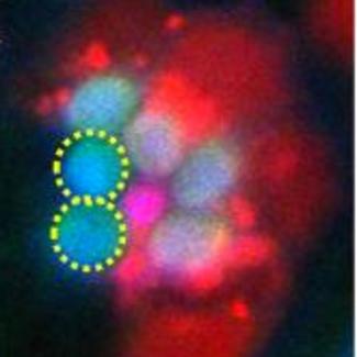Insufficient energy production by mitochondria causes photoreceptor neurons to degenerate