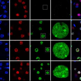 Mutation location is the key to prognosis