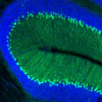 Regulating gene regulatory regions offers a novel mechanism to control ATXN1 levels