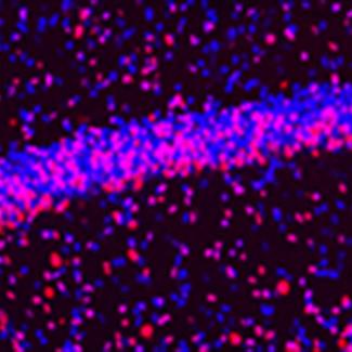 Deep brain stimulation can correct neural malfunction in Rett and MeCP2 duplication syndrome mice