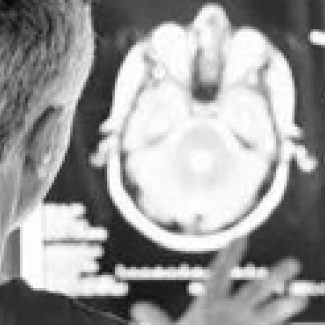 CURE Epilepsy’s Day of Science: March 30