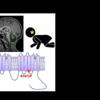 Studies on a young ataxia patient could guide treatment for a novel condition