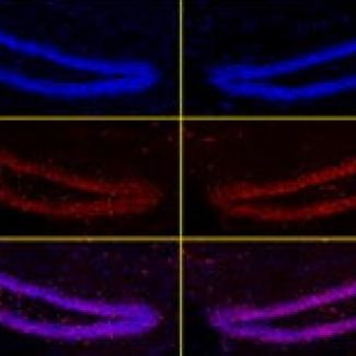 Deep brain stimulation restores learning and memory in Rett Syndrome mice