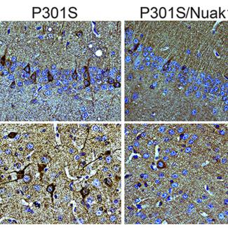 A kinase that restores memory and cognitive defects in a mouse model of Alzheimer's disease discovered